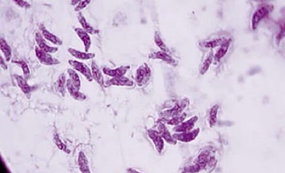 protozoan parasite toxoplasma gondii is the causative agent of toxoplasmosis