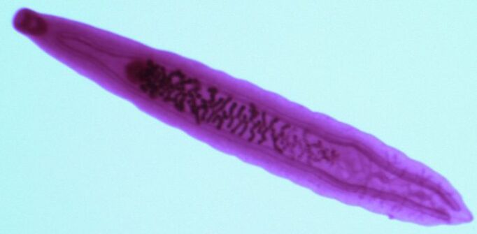 parasite from the human body